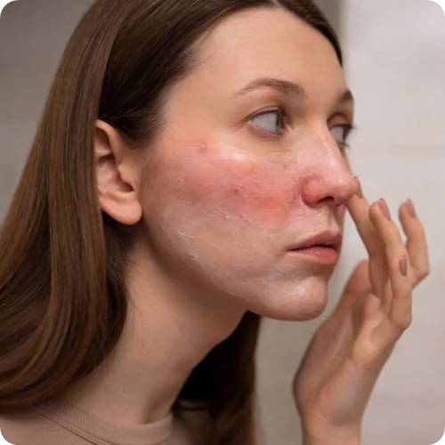 민감성 피부 세안제 고르는법