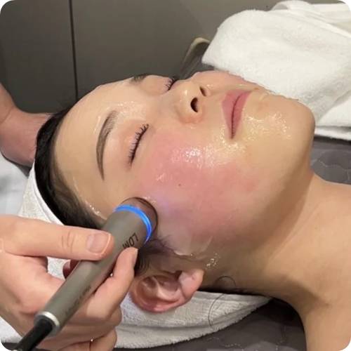 피부 시술 직후